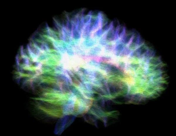 یکی از اسرار مغز آشکار شد ، دقیق ترین نقشه مرکز حافظه، عکس