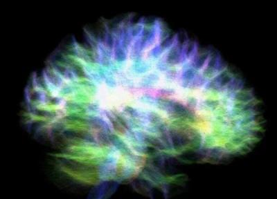 یکی از اسرار مغز آشکار شد ، دقیق ترین نقشه مرکز حافظه، عکس